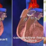 Understanding Congestive Heart Failure: A Comprehensive Guide Made Easy.