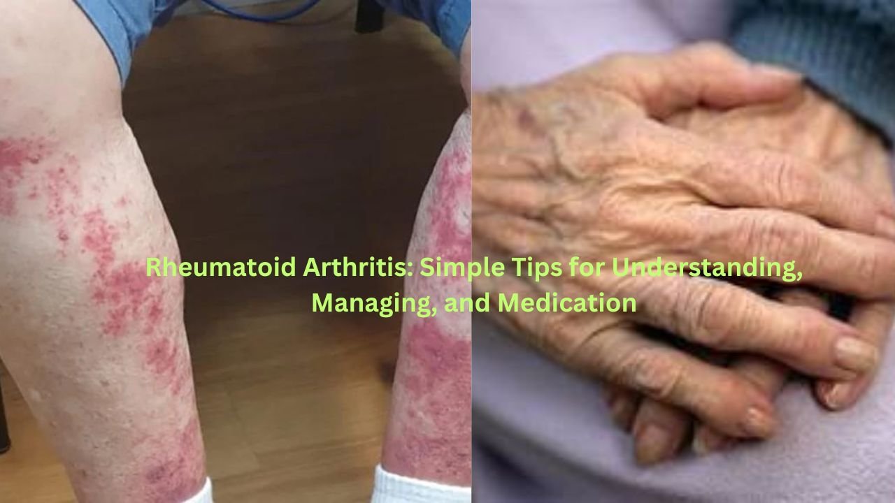 Rheumatoid Arthritis: Simple Tips for Understanding